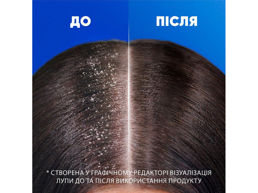 Шампунь и бальзам-ополаскиватель против перхоти Head&Shoulders 2в1 Гладкое и шелковистое, 330мл